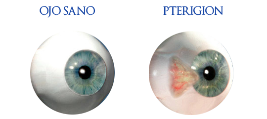 oftalmologos en guadalajara, clinica oftalmologica, clinica oftalmologica en guadalajara